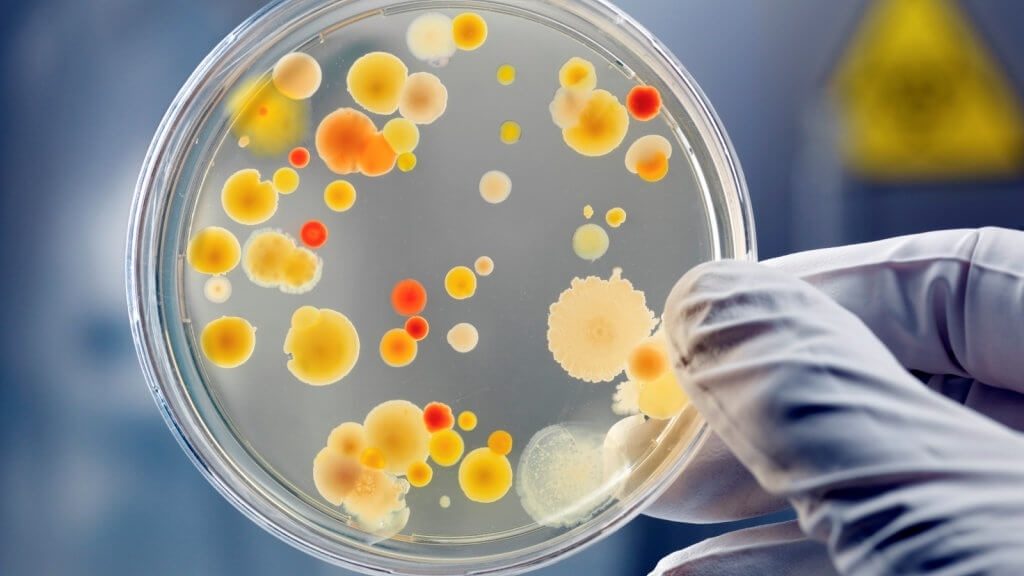 food bacteria